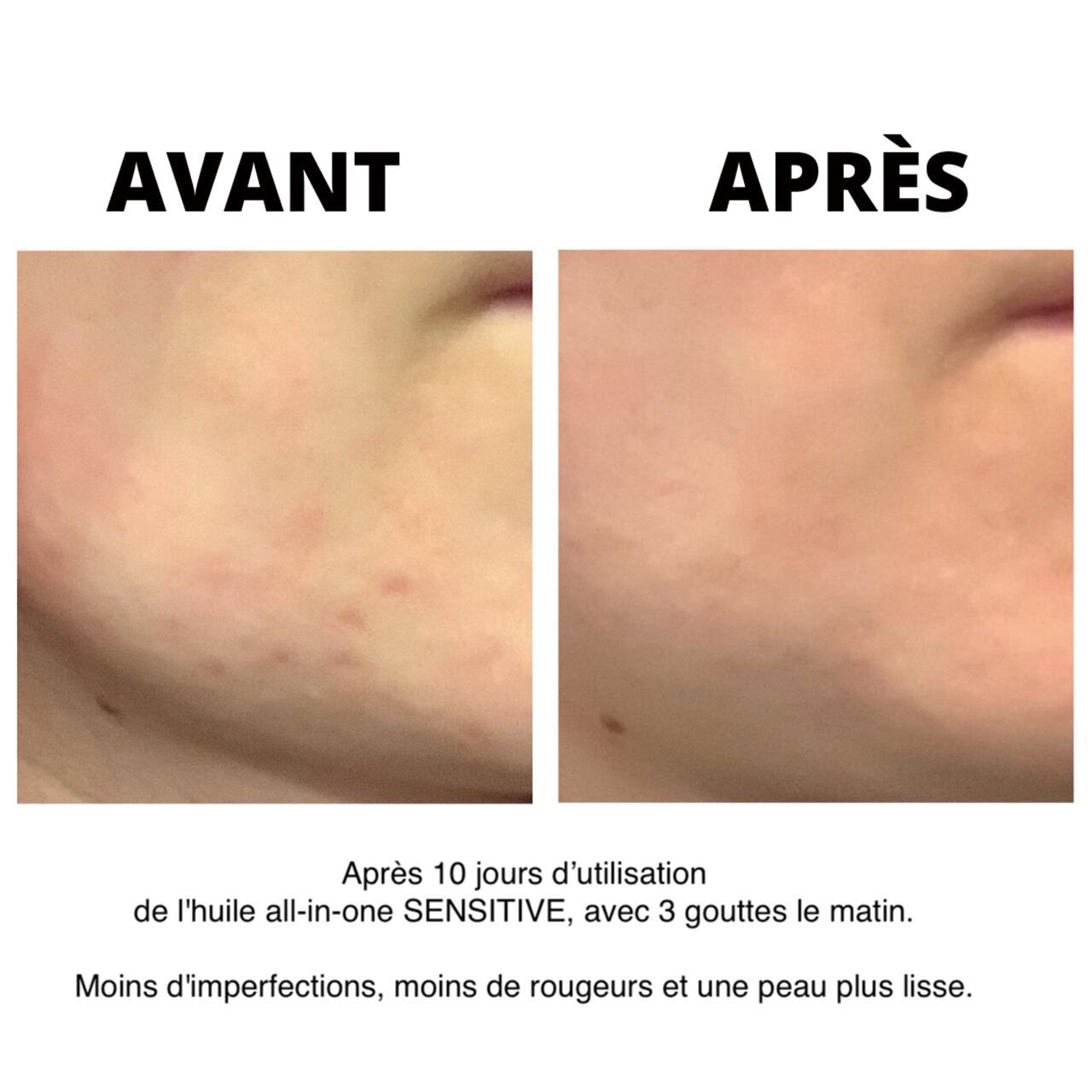 mon huilette Sensitive 30ml モン ユイル センシティブ